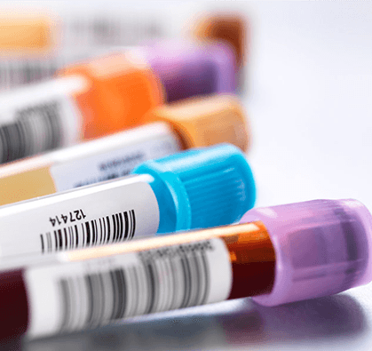 The Various Reasons That Triggers DNA Testing