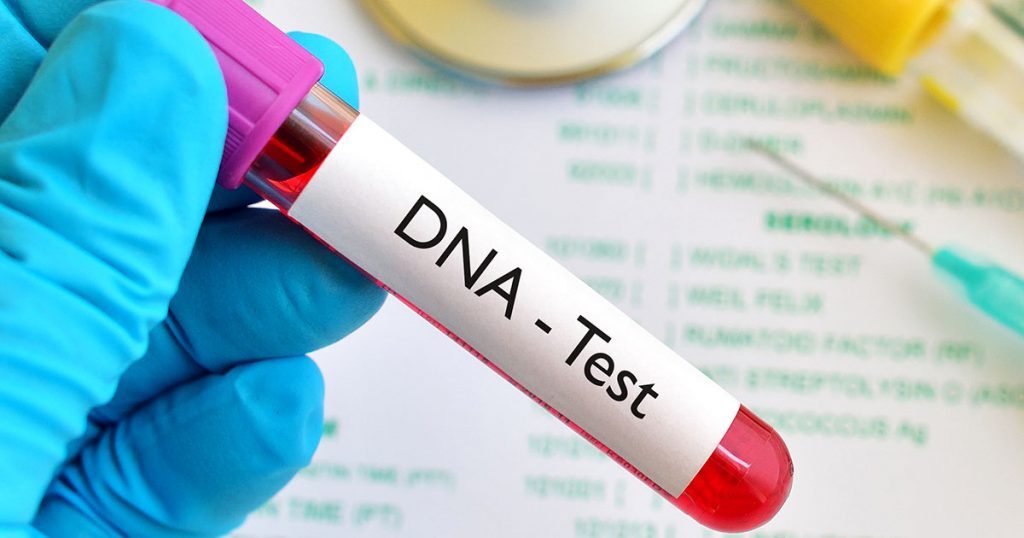 Where Can I Do Dna Test In Gauteng