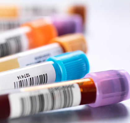 blood sample collections tubes - smart dna nigeria